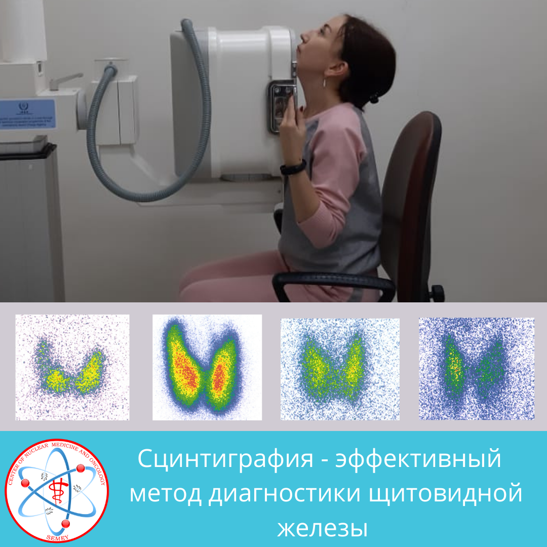 Классификация по тирадс щитовидная железа. Почки на белом фоне. Аденома паращитовидных желез на кт. Почка изображение. Стентография.